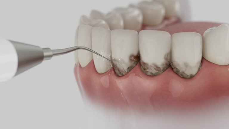 Trusted Teeth Whitening service in Crofton, MD - Dentist Open Now